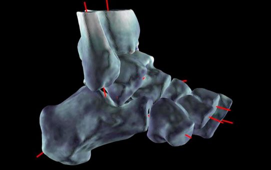 Perspektive DVT – Präoperative Planung und postoperative Kontrolle mit dem SCS DVT