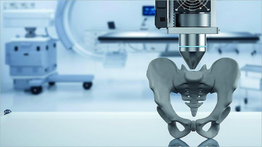 3D Druck in der präoperativen orthopädischen Planungsphase