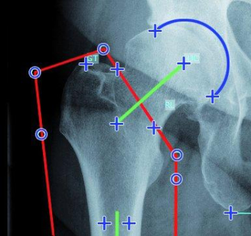 mediCAD® 6 – die neue Version ist da!