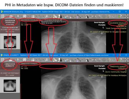 Patientendaten schützen ❌ Kritische Gesundheitsdaten in bspw. DICOM-Dateien automatisch finden und via Datenmaskierung schützen ❗