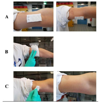 Neuartiges Polymer für Wundauflagen, die sich dadurch schmerzfrei und ohne Rückstände ablösen lassen