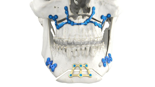 Neue medizinische 3D-Druck Produktionsstätte bringt personalisierte Versorgung näher an die Patienten in den USA heran